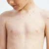 MMRV Vaccine